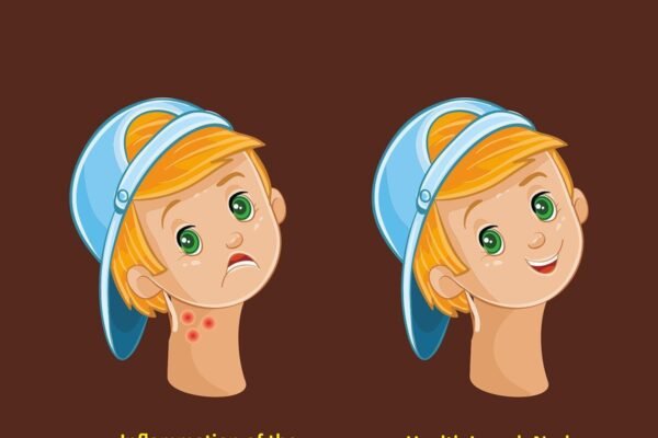 Is your child having enlarged Lymph Nodes or Lymphadenitis