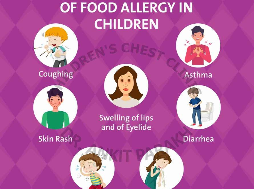 Food Allergy: What are the most common symptoms?