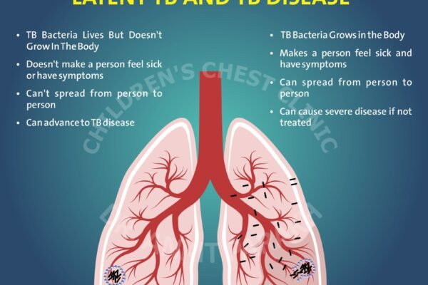 Latent Tuberculosis or Tuberculosis disease: What is the difference?