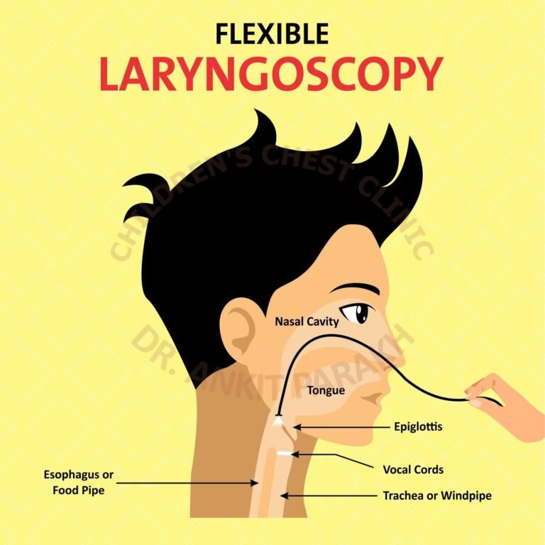 When is a Flexible Laryngoscopy required in children