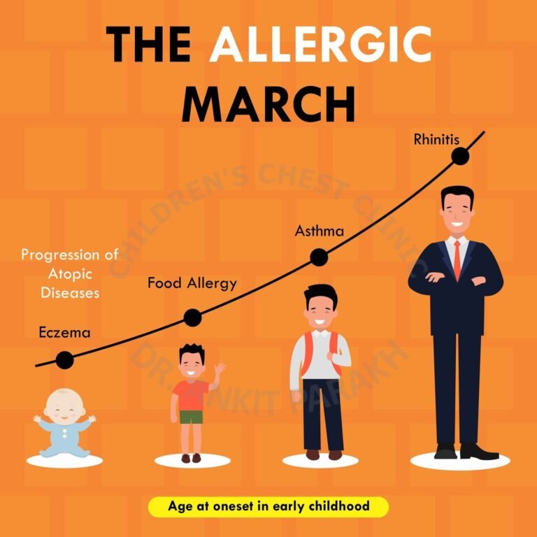 What Is the Allergic March?