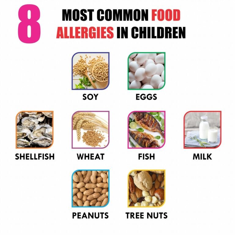Food Allergy: What are the most common causes of food allergy?