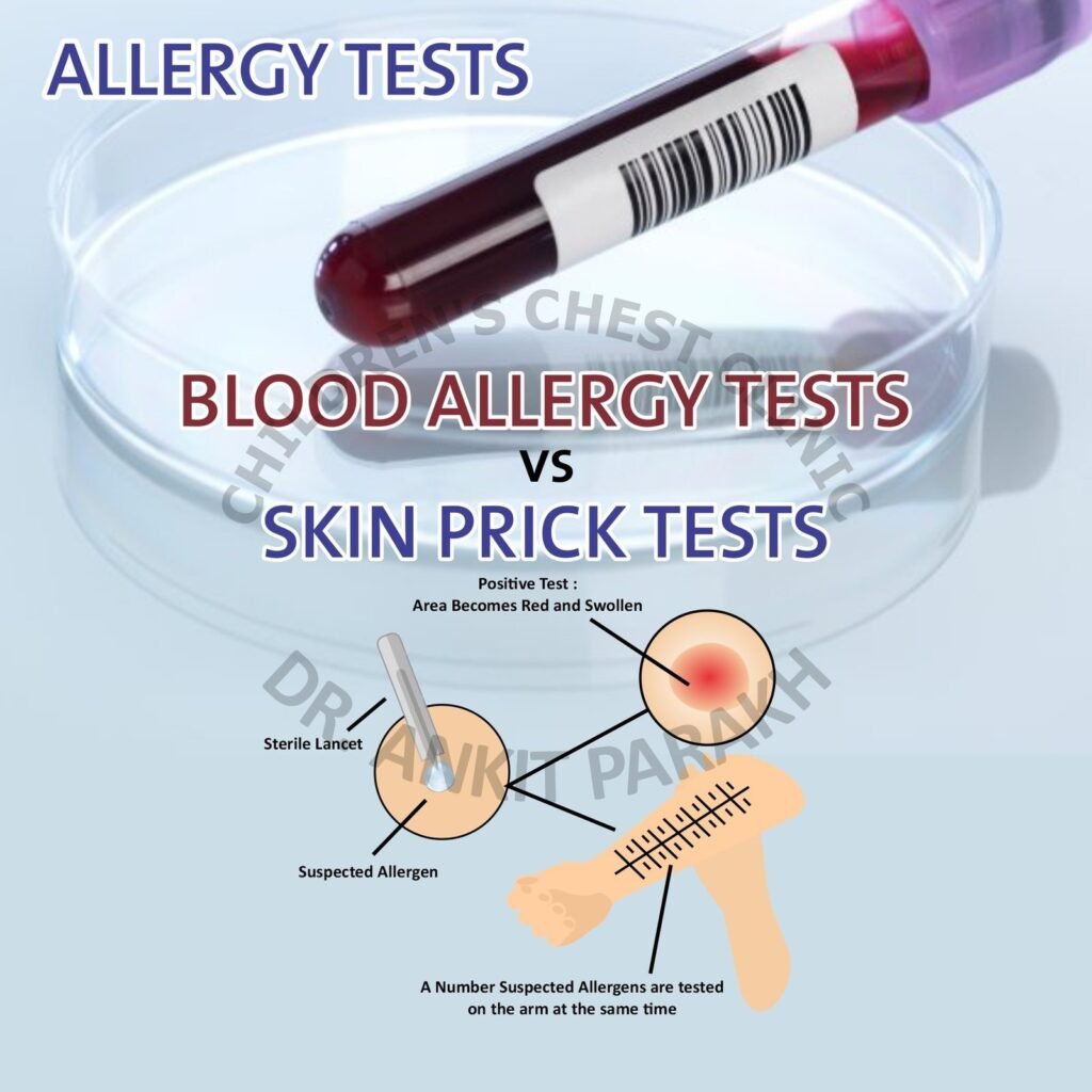 Skin Prick Test (SPT) vs Blood Allergy Tests