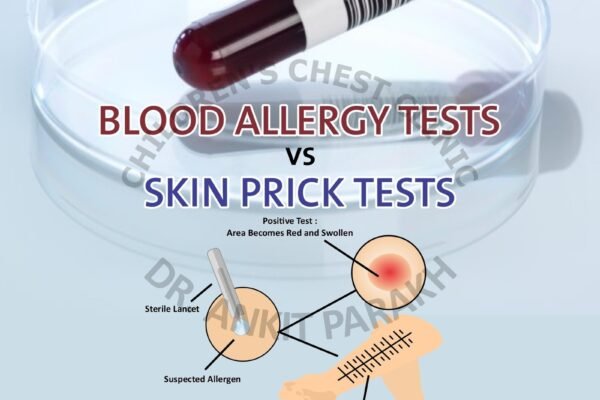 Skin Prick Test (SPT) vs Blood Allergy Tests