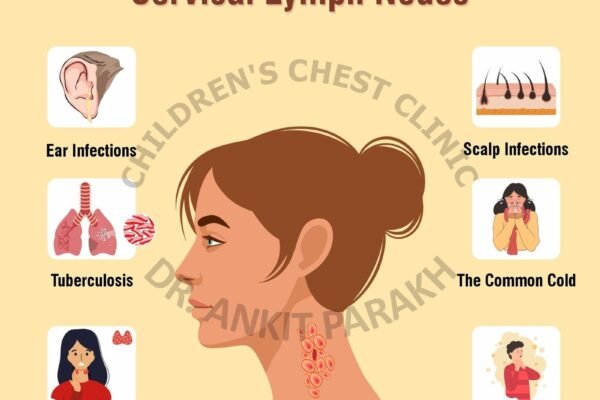 COMMON CAUSES OF SWOLLEN CERVICAL LYMPH NODES