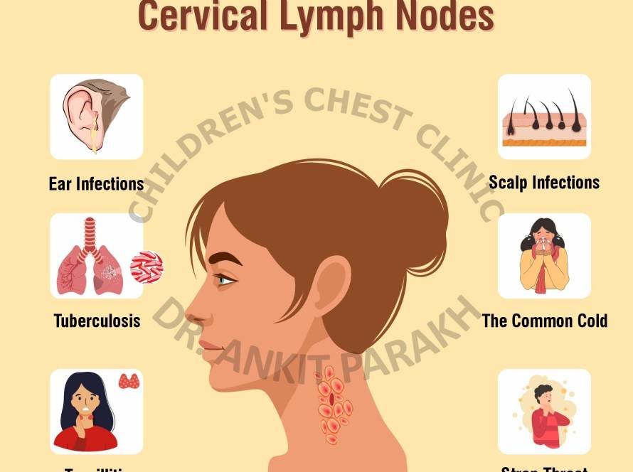 COMMON CAUSES OF SWOLLEN CERVICAL LYMPH NODES
