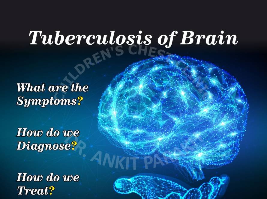 Tuberculosis of the Brain