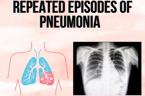 Repeated episodes of Pneumonia