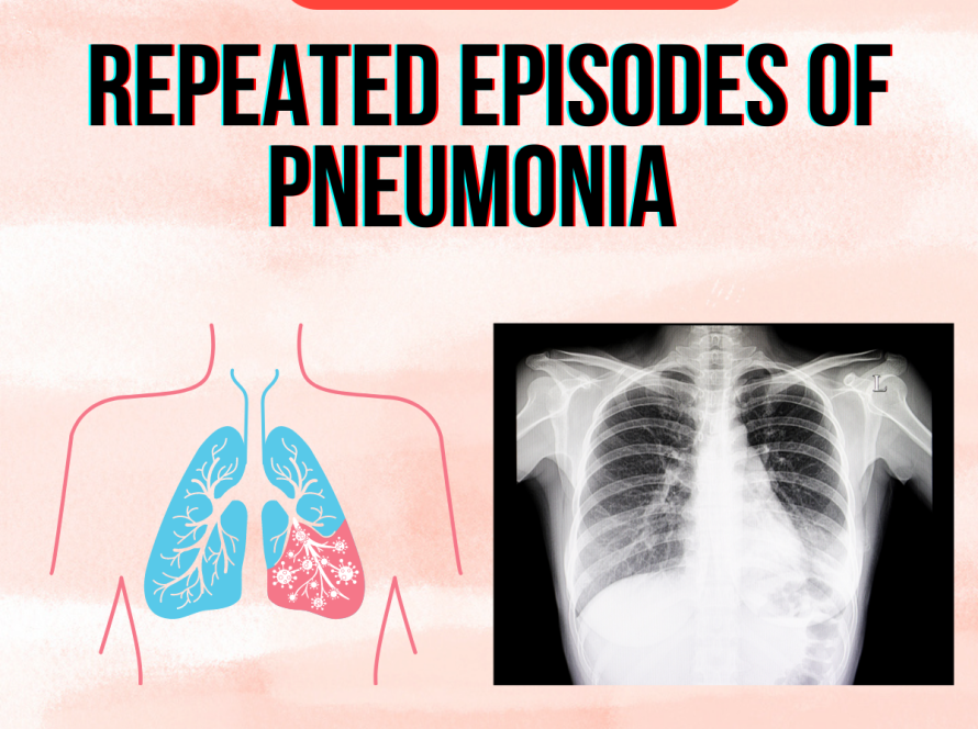Repeated episodes of Pneumonia