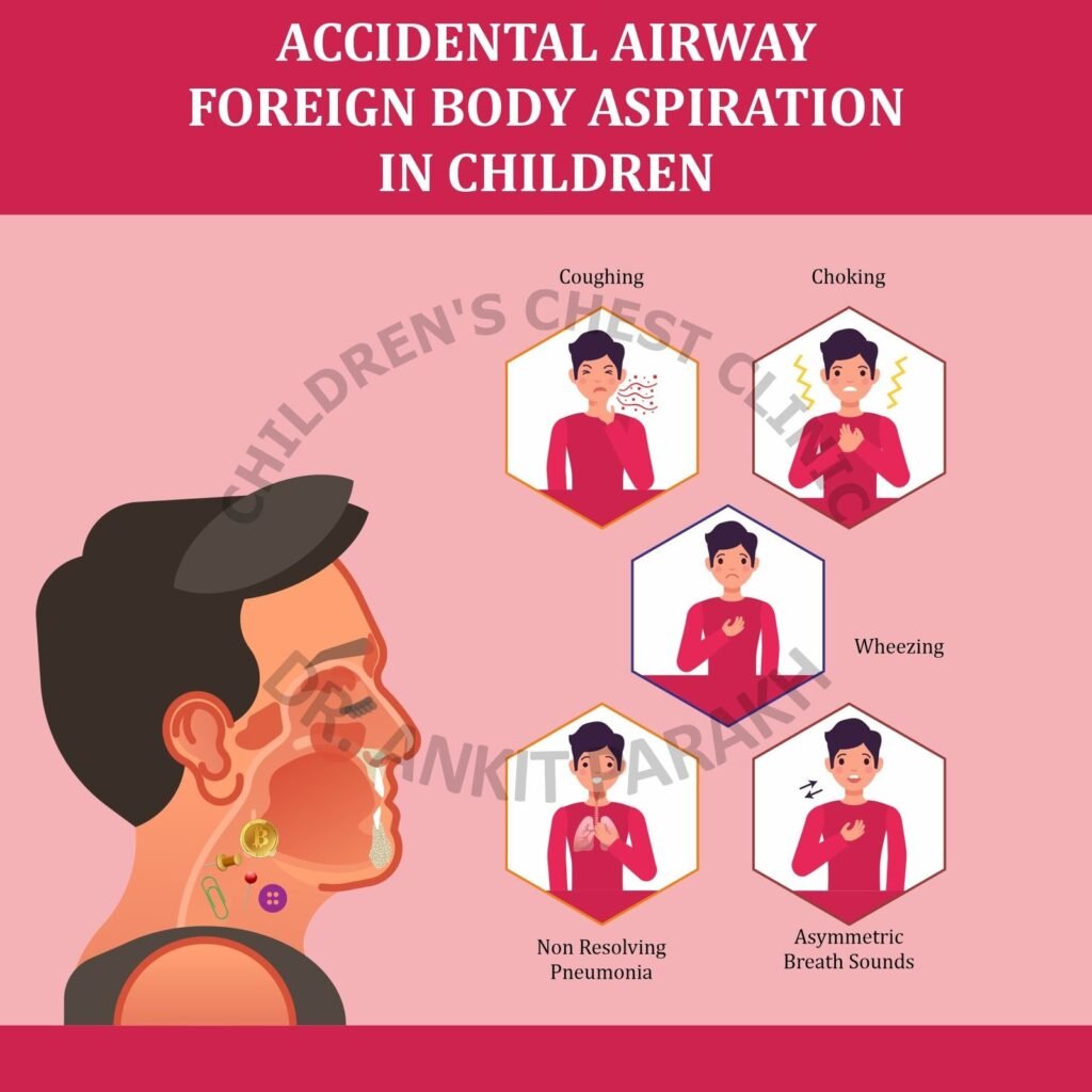 Foreign Body Aspiration in Children: Symptoms, investigations and treatment