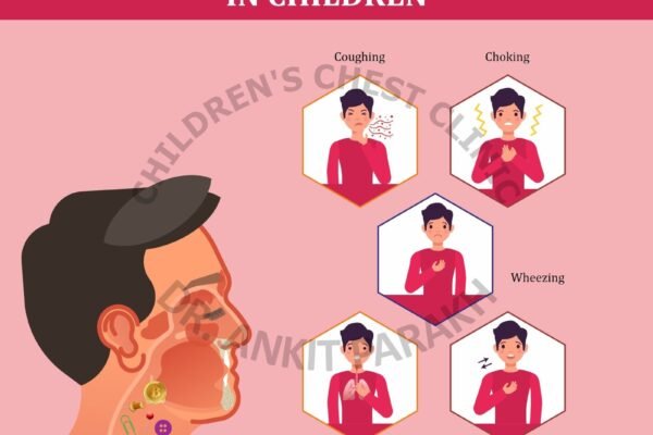 Foreign Body Aspiration in Children: Symptoms, investigations and treatment