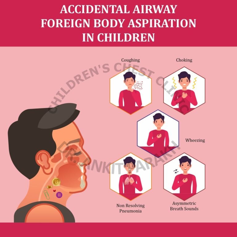 Foreign Body Aspiration in Children: Symptoms, investigations and treatment
