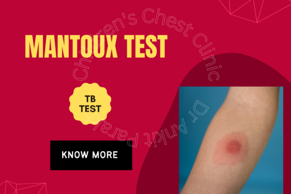 Mantoux Test or Tuberculin Skin Test