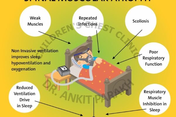 Sleep Problems in children with Spinal muscular atrophy (SMA)?