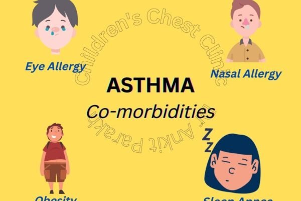common comorbidities associated with Asthma