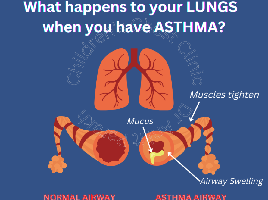 What happens to lungs in Asthma