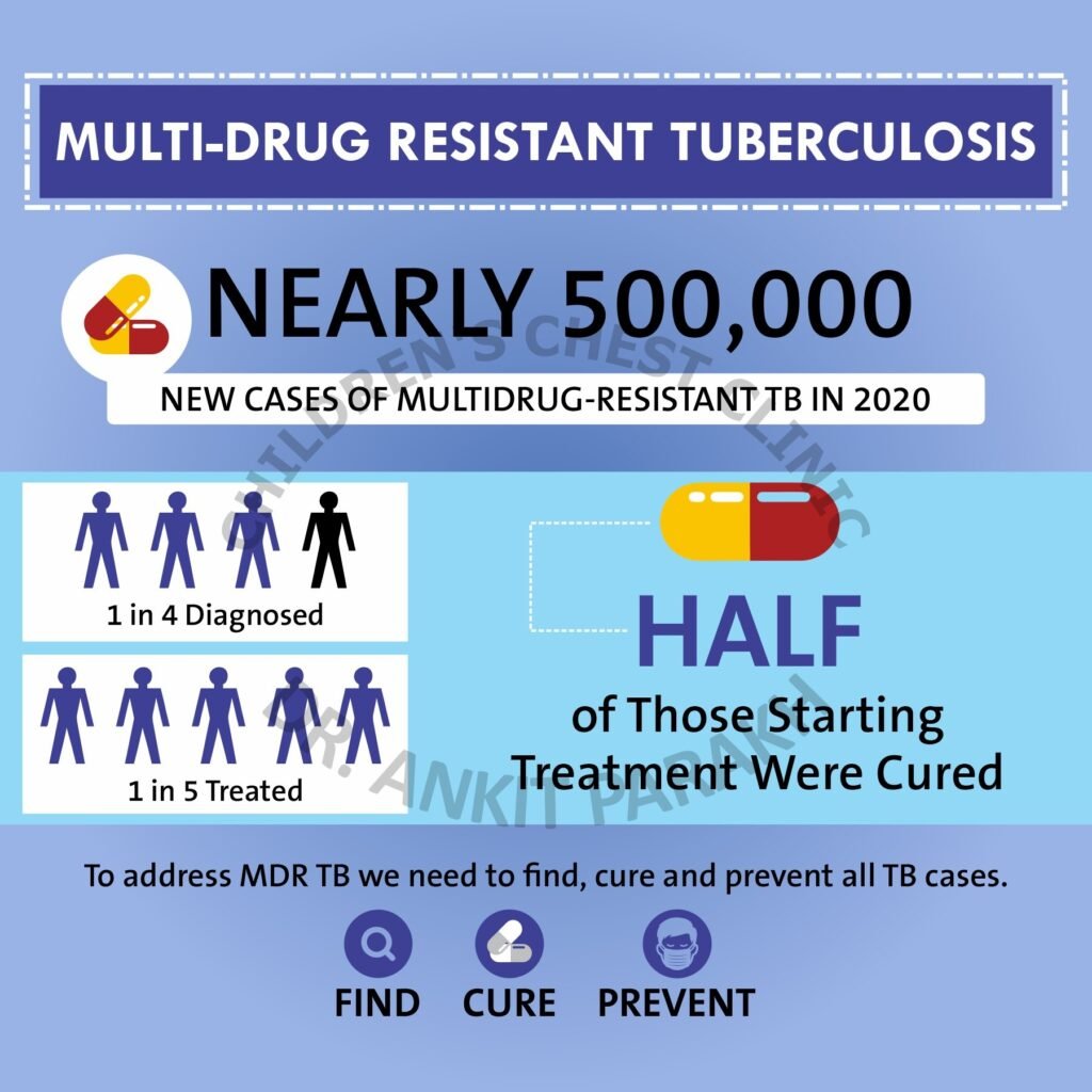 Multi Drug Resistant Tuberculosis in Children