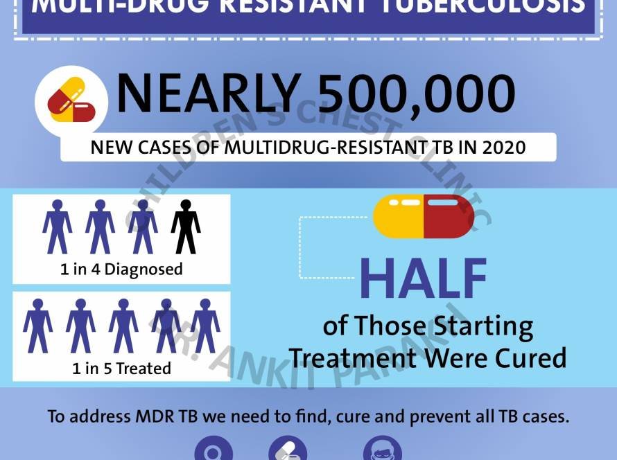Multi Drug Resistant Tuberculosis in Children