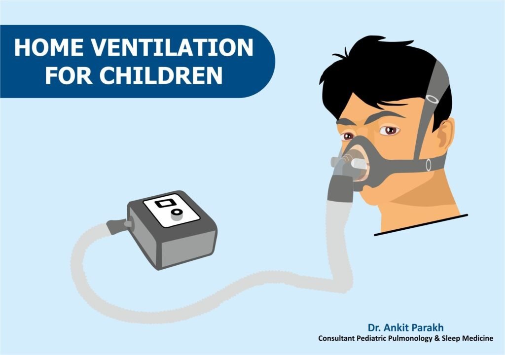 Long term Night time Home Non Invasive Ventilation in children