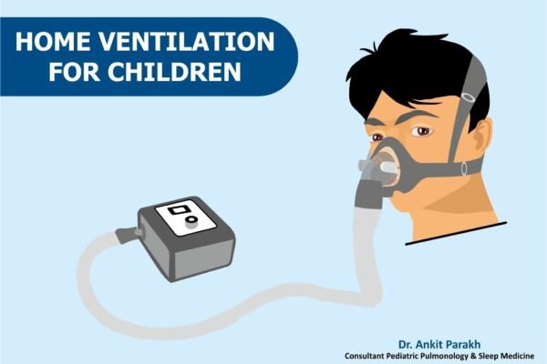 Long term Night time Home Non Invasive Ventilation in children
