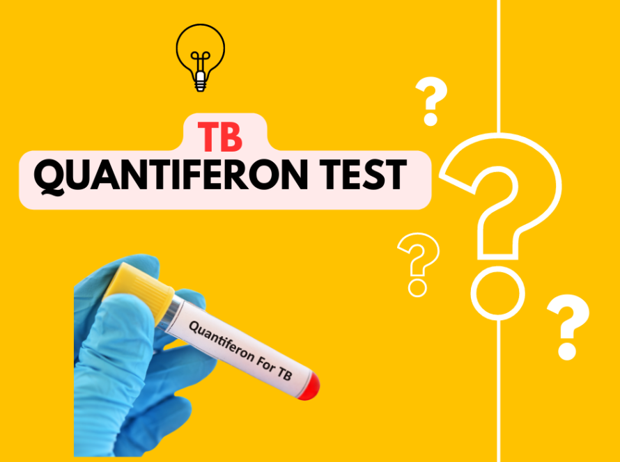 Quantiferon TB