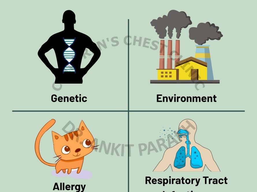 Do you know: What causes Asthma?