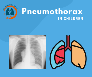 Pneumothorax in Children