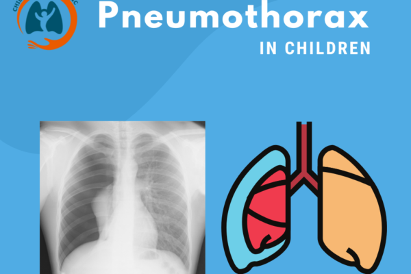 Pneumothorax in Children