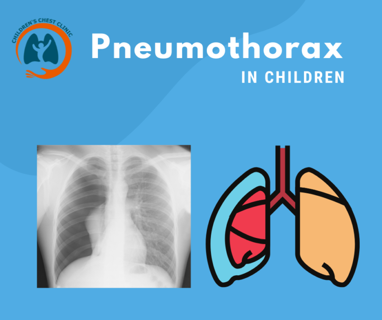 Pneumothorax or Air in the Pleural Cavity in Children