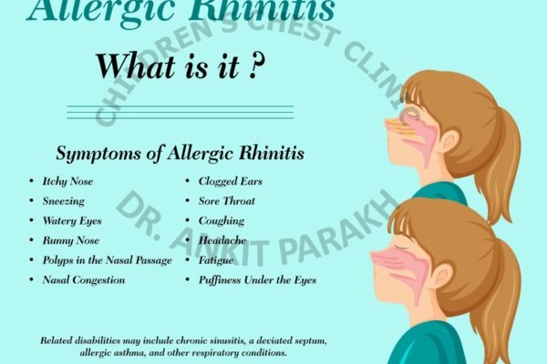 Allergic Rhinitis or Nasal Allergy