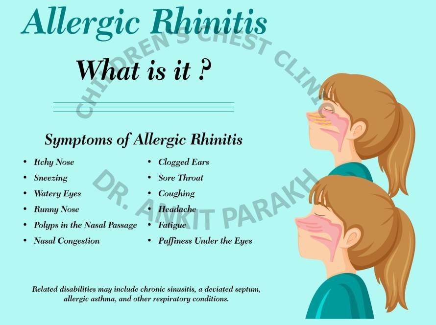 Allergic Rhinitis or Nasal Allergy