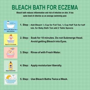 Bleach Baths for children with Atopic dermatitis or eczema!