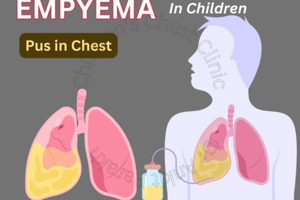 Empyema or Pus in the Pleural Space in Children!!