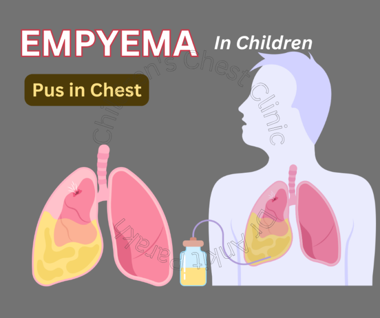 Empyema or Pus in the Pleural Space in Children!!