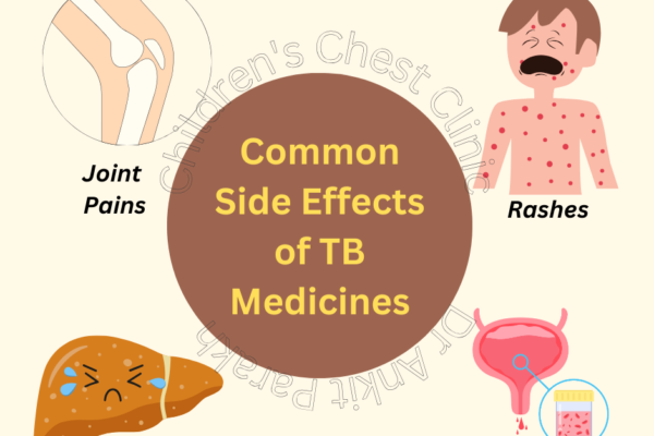 Side Effects of Anti-Tuberculosis (TB) Medicines
