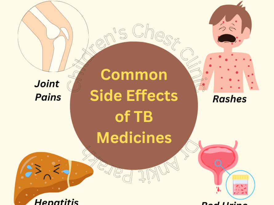 Side Effects of Anti-Tuberculosis (TB) Medicines