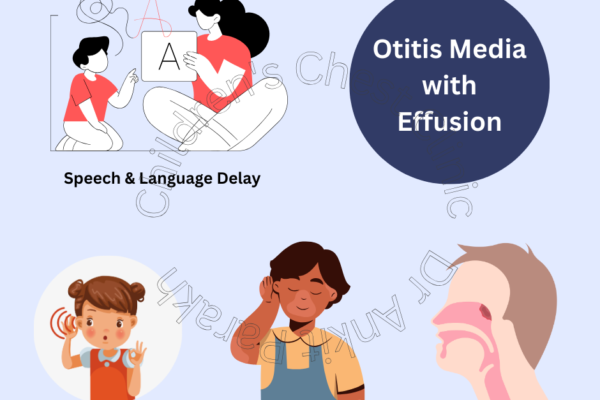 Otitis media with effusion (OME) in Children