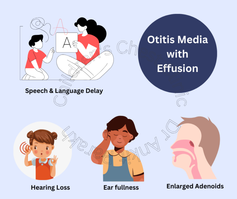 Otitis media with effusion (OME) in Children or Glue Ear!