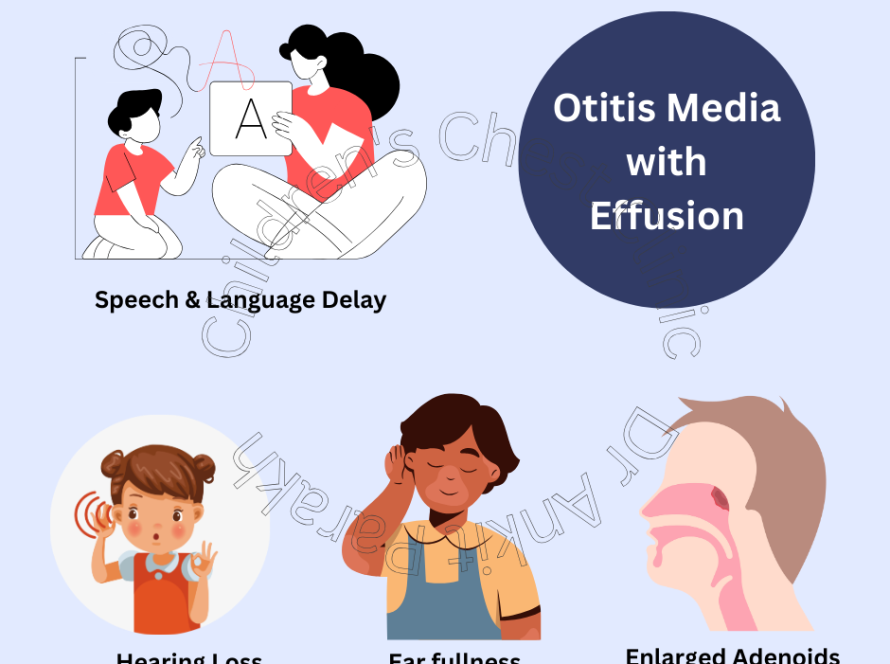 Otitis media with effusion (OME) in Children