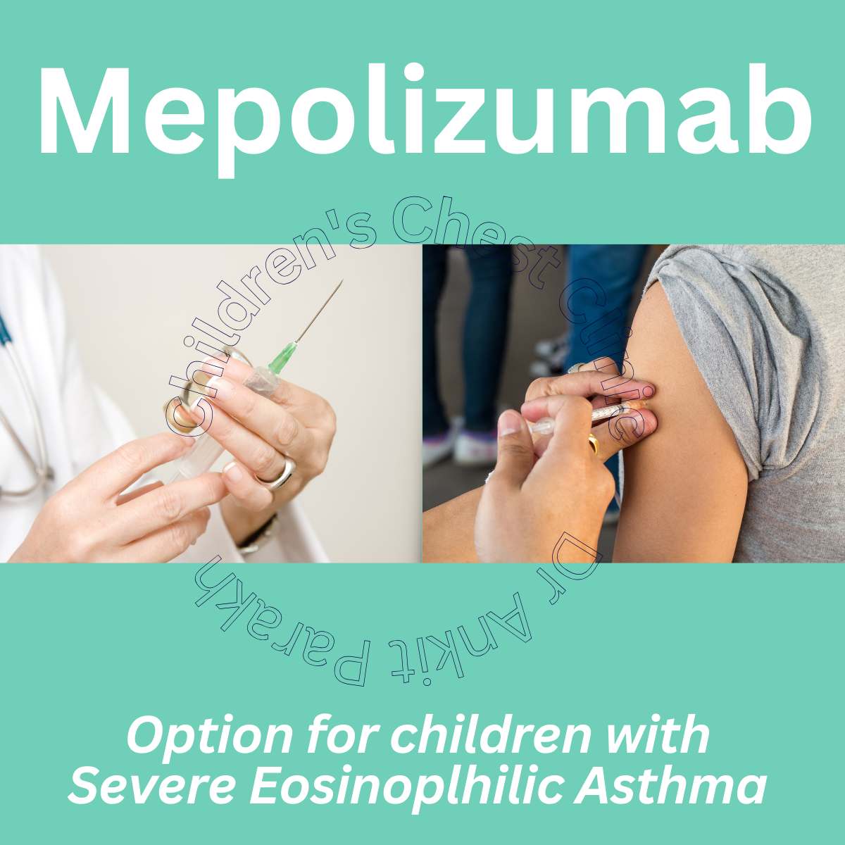 MEPOLIZUMAB: A new medicine for SEVERE ASTHMA in children