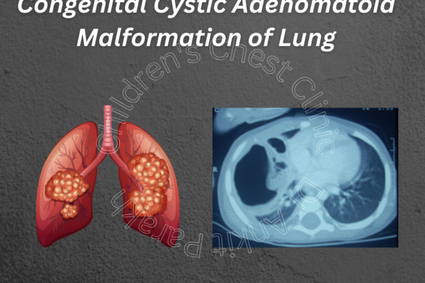 Congenital Cystic Adenomatoid malformation of Lung (CCAM)