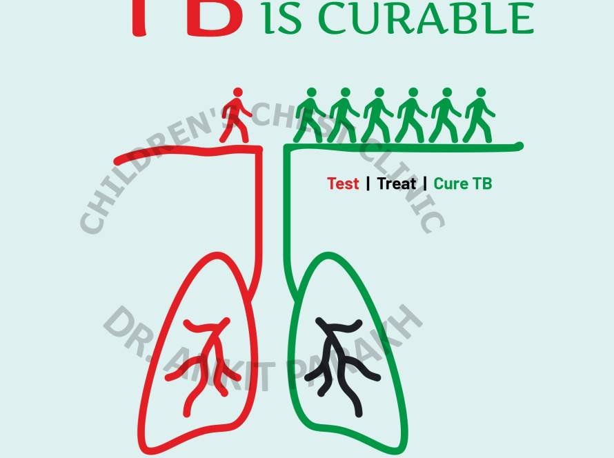 DO YOU KNOW: Tuberculosis or TB is Curable!!