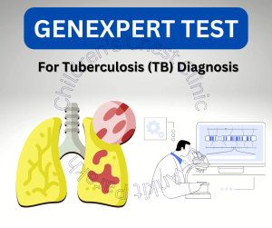 GeneXpert test