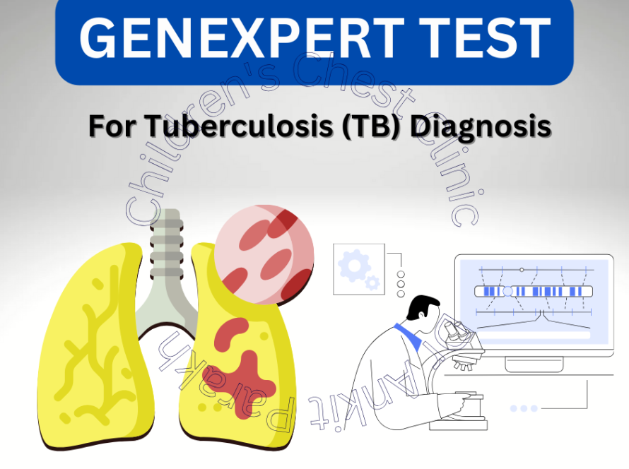 GeneXpert test