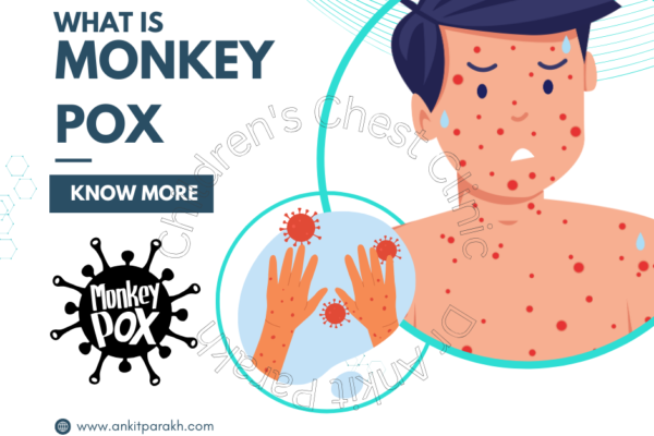 Current Status of Monkeypox in India: A 2024 Update