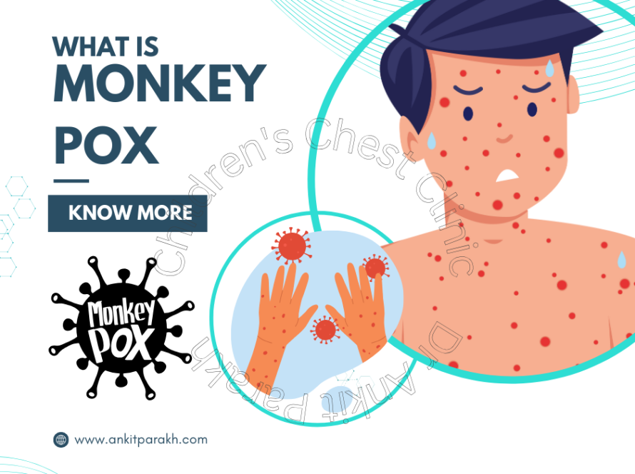 Current Status of Monkeypox in India: A 2024 Update