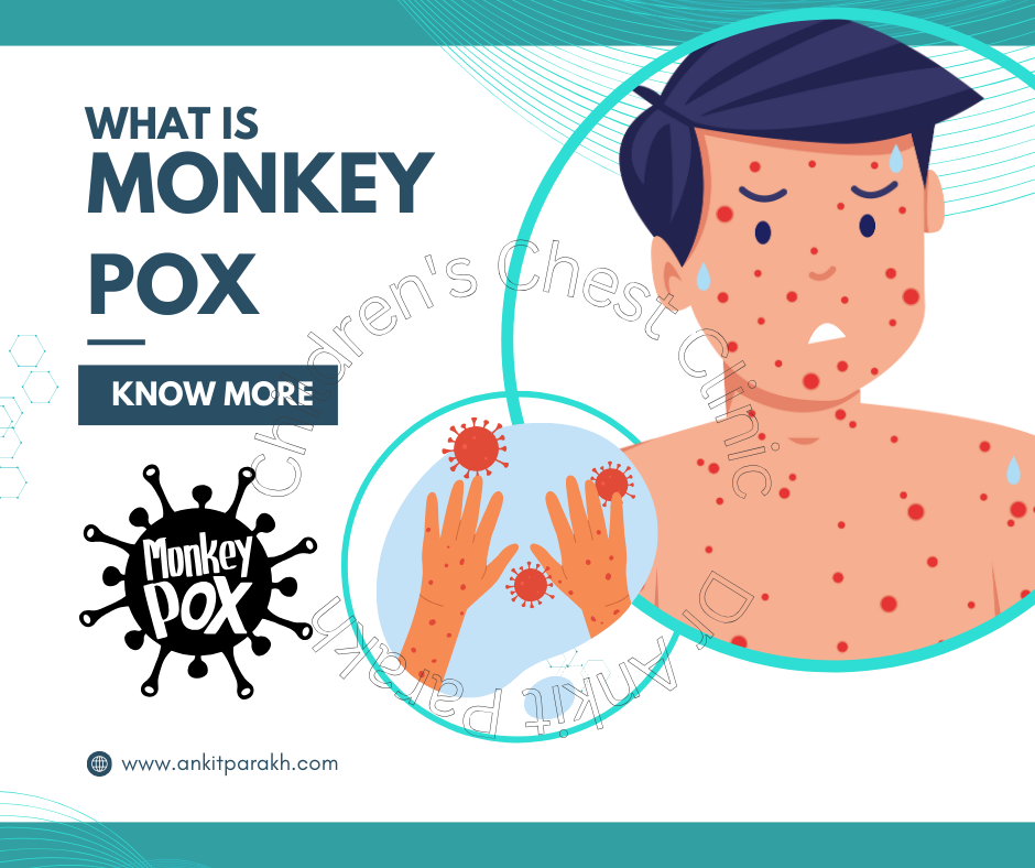 Current Status of Monkeypox in India: A 2024 Update