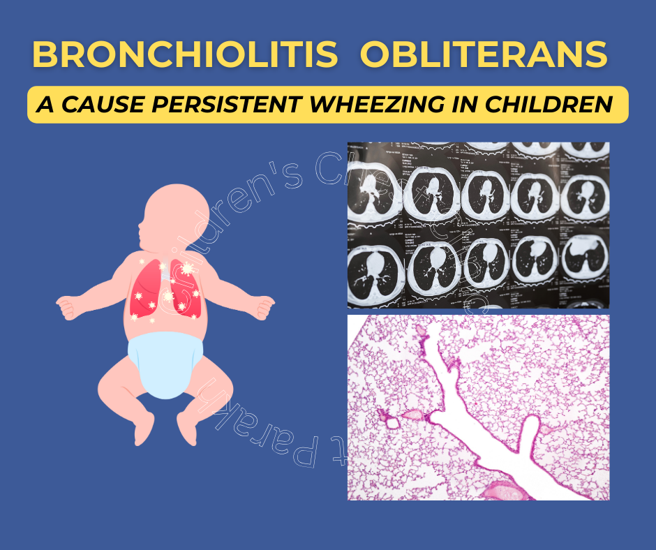 Bronchiolitis Obliterans