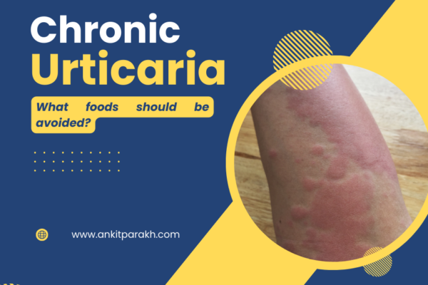Chronic Urticaria