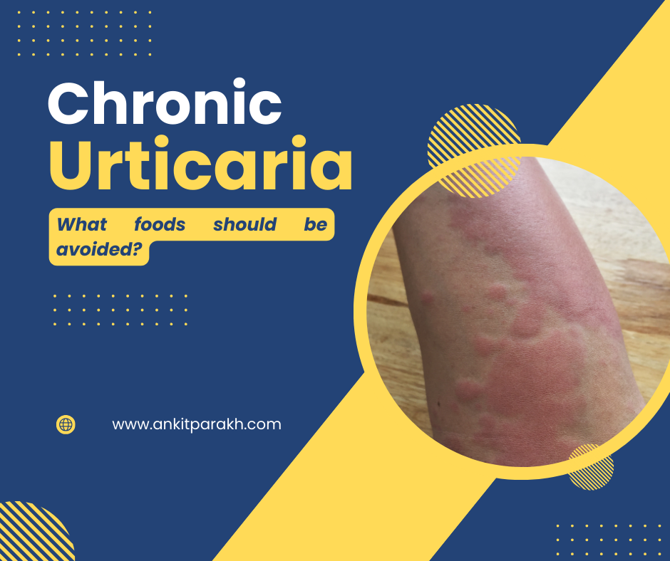 Chronic Urticaria